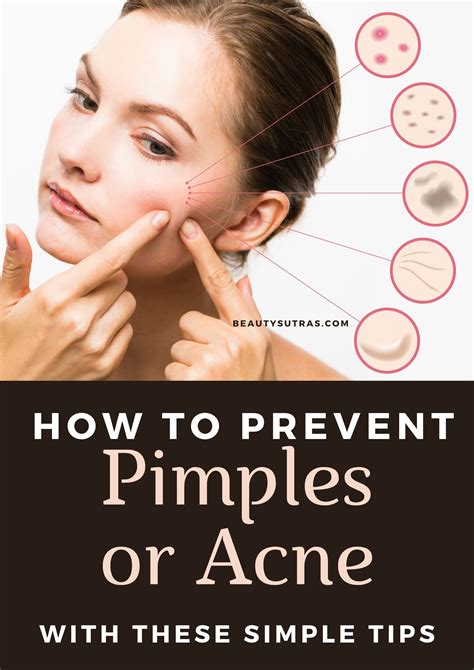 How To Treat And Prevent Skin Blemishes And Breakouts?